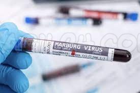 "علاج فيروس ماربورغ المنتشر في السعودية" الصحة تحذر من السفر لهذه الدول