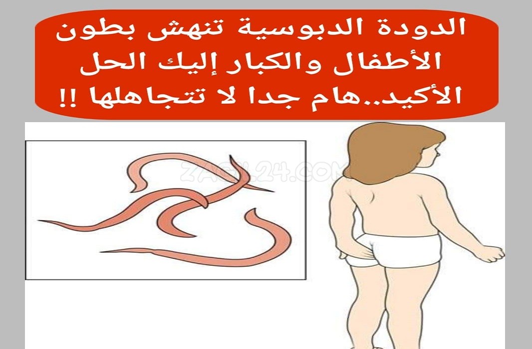 الديدان الدبوسية