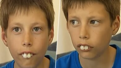 الطفل الارنب